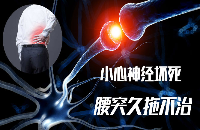 腰椎間盤突出壓迫神經怎么鍛煉 腰椎間盤突出壓迫神經怎么鍛煉