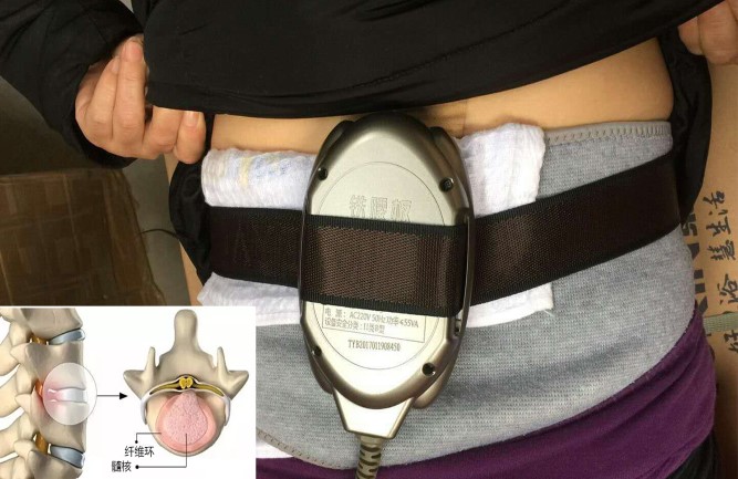 這個簡單的治療方法也許適合你 這個簡單的治療方法也許適合你