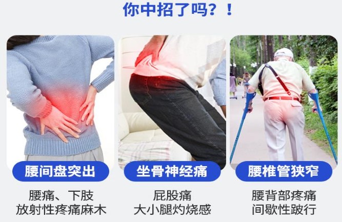 長期壓迫神經腰疼怎么治療 長期壓迫神經腰疼怎么治療